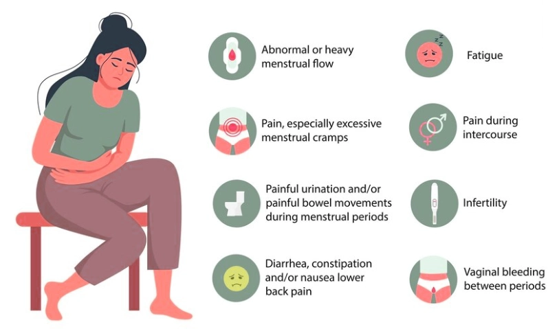 Symptoms of Endometriosis