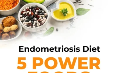 Endometriosis Diet 5 Power Foods to Control Pain Naturally!