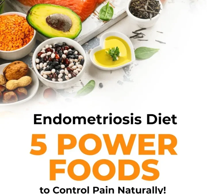 Endometriosis Diet 5 Power Foods to Control Pain Naturally!