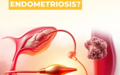 Can you use an IUD if you have endometriosis?