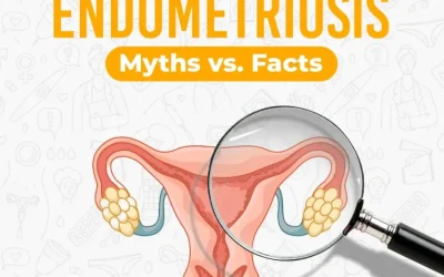 Endometriosis Myths vs Facts