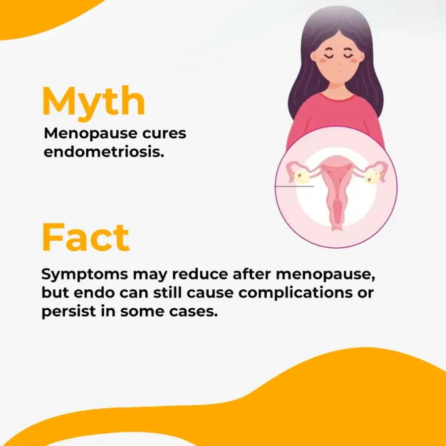 Endometriosis Myths vs Facts
