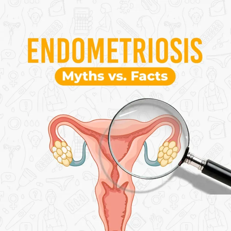 Endometriosis Myths vs Facts
