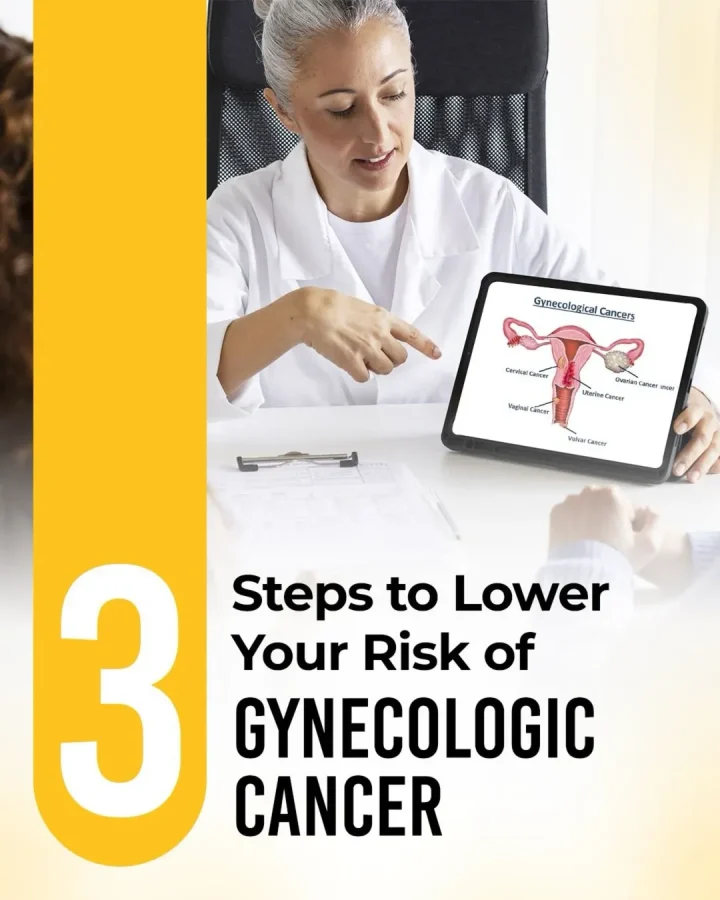 Steps to lower Your Risk Of Gynecologic Cancer